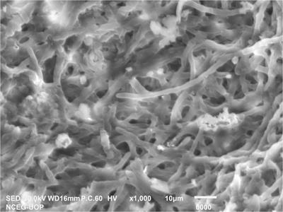 First identification of potato tuber rot caused by Penicillium solitum, its silver nanoparticles synthesis, characterization and use against harmful pathogens